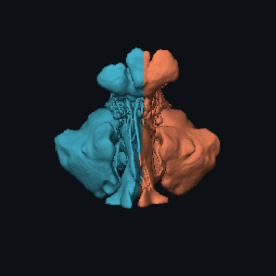 Rotating 3D air cast, right side teal, left side coral